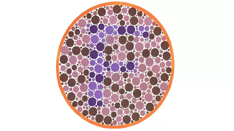 Por favor, selecciona la letra en la imagen.