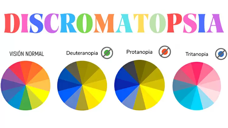 Protanomalía/Deuteranomalía